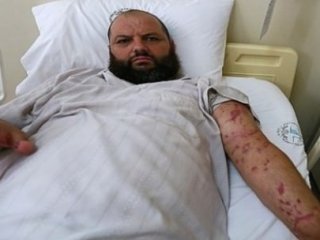 O Hastalığını Türkiye'de Öğrendi