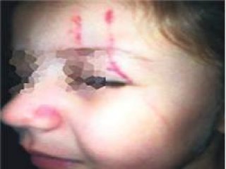 Küçük Kıza Anaokulunda Dayak!