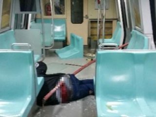 Metroda Kalçasına Demir Giren Genç O Anı Anlattı