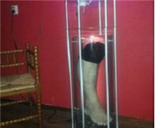 Kesilen Bacağını Bakın Ne Yaptı!