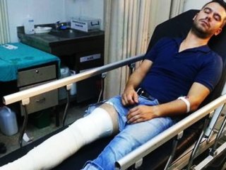 Bacağından Vurdular! Bakın Kimin Kardeşi Çıktı?