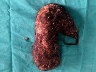 Doktorlar Bile Şaşkına Döndü!