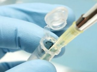 Kanser Kayıt Sistemi Geliştirilecek