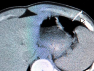 Şakanın Sonu Hastanede Bitti