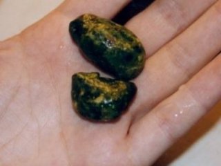 Bu Taş Öldürüyor!