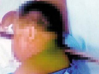 Böyle Kaza Görmediniz! Yüzünden Girip..