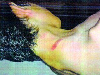 Uzaklaştırma Trajedisi!