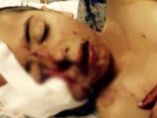 Katiller Bu Hale Getirdi!