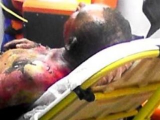 Elektrik Akımına Kapılan İşçi Ağır Yaralandı