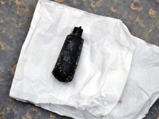 Cizre'de Ölen Çocuğun Başından Çıkan Mermi