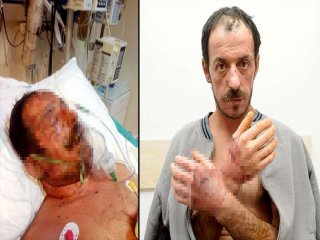 Oğlu Dövdü Eşi Benzin Döküp Yaktı