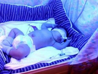 Poyraz Bebek Artık Hastahanede