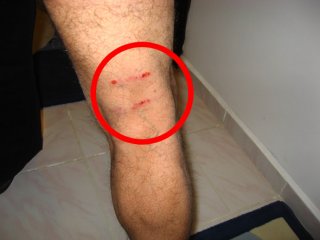 AVM'de Köpek Dehşeti