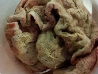 Şok Eden Olay! Bu Yüzden Ölüyordu