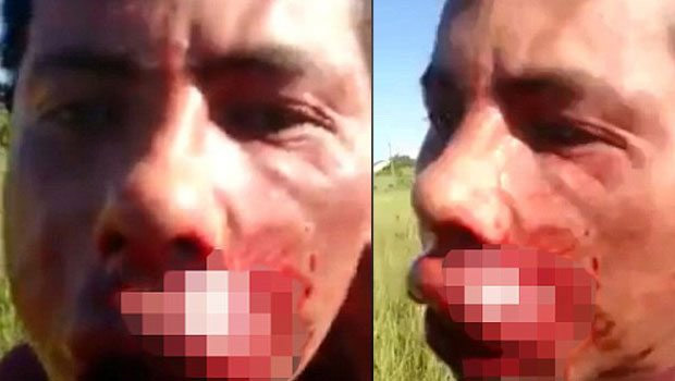 Genci Kameranın Karşısında Öldürdü