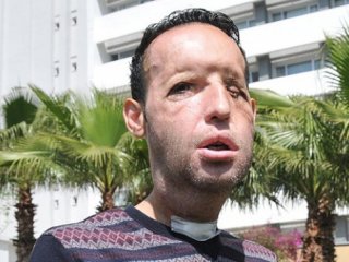 Recep Sert'ten Kötü Haber