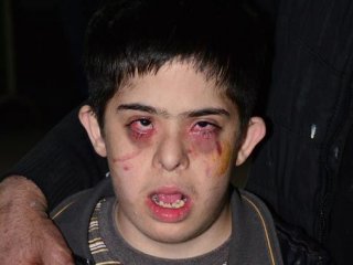 Eve Bu Halde Geldi! Babası İsyan Etti