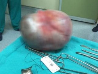 Böylesini Görmediniz! Karnından Çıktı