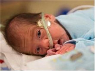 Öldükten 2 Ay Sonra Doğum Yaptı