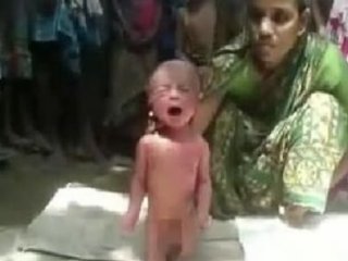 İki Günlük Bebeğe Akıl Almaz Uygulama