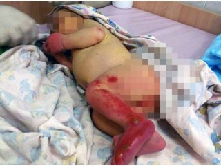 Karıncalar Yerken Bulundu