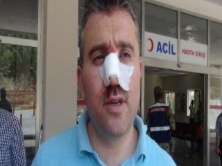 Sandık Başkanını Döverek Hastanelik Ettiler