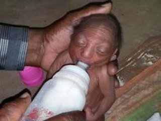 Bebek Çirkin Diye Terk Edildi!