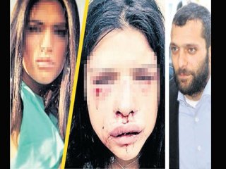 Özbizerdik'in Dövdüğü Kadın Geri Adım Attı!