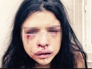 ''Anne Kurtar Beni Ölüyorum'' Dedi