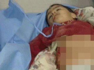 Kadın Doğum'a Bombalı Saldırı