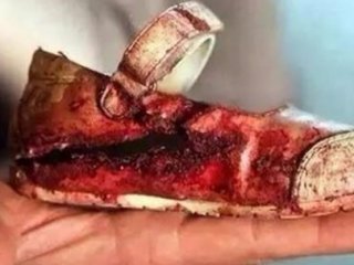 Terör Yandaşları Hainlikte Sınır Tanımıyor!