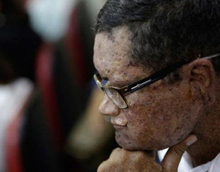 Bu Köyde Güneş Işığı Gören Eriyor!