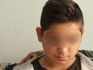Gözlerine 17 Dikiş Atıldı!