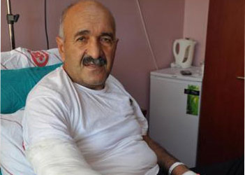 Ağaç Yakarken Kendini Yaktı