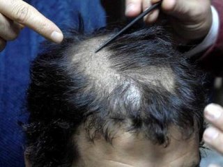 Müşterisi İçin Kendini Feda Etti!