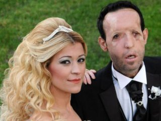 Yüz Nakilli Recep Sert Baba Oldu