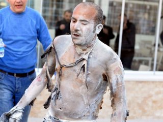 Üzerine Benzin Döküp Kendini Yaktı