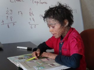 Küçük Melih’in Dramı Yürek Burkuyor