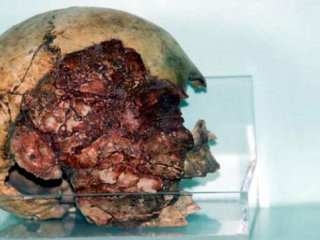 7 bin 200 yıllık kafatasına büyük ilgi