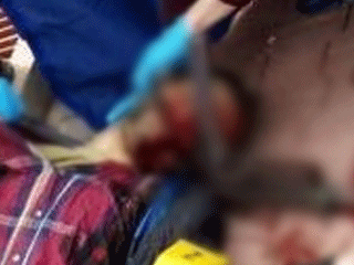 Çatışmada öldürülen terörist DHKP-C'li çıktı