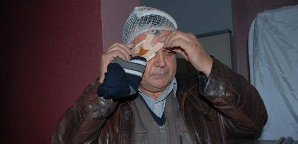 MHP'li başkana dayak suçlaması