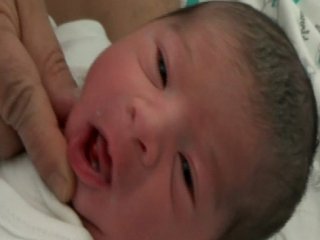 Dünyaya 2 dişiyle merhaba dedi