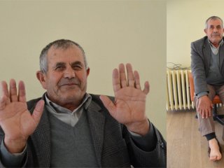 24 parmağıyla herkesi şaşırtıyor