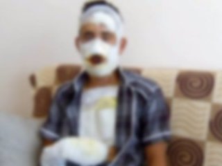 Askerin üstüne kolonya döküp yaktılar