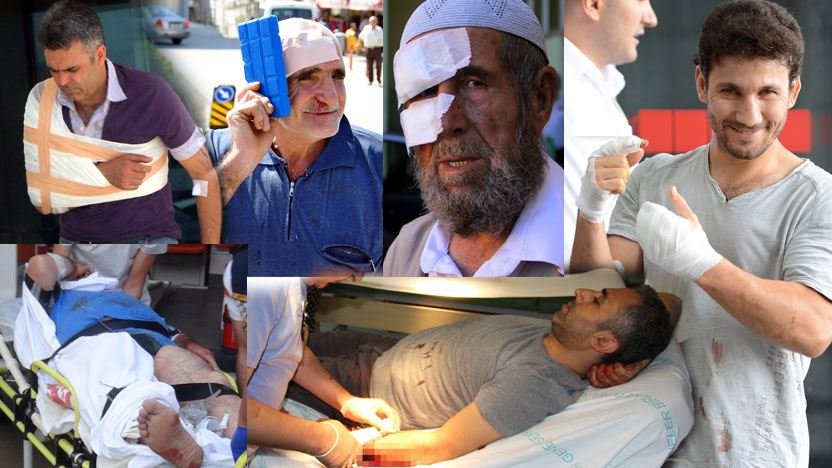 3 bin 541 acemi kasap hastanelik oldu