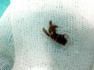 İki hastanın kulağından çıkanlar şaşkına çevirdi