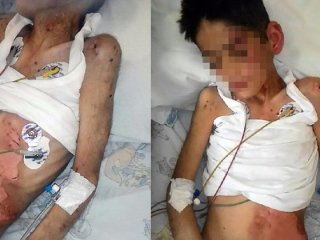 Vicdansız anne çocuğunu hastanelik etti!