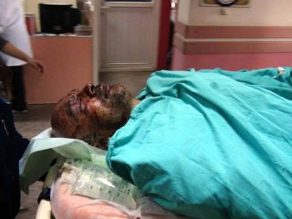 Define arama sırasında patlama: 3 yaralı