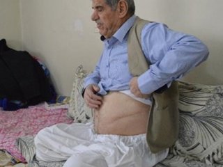 45 yıllık sigara bağımlısının ibretlik hikayesi