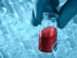 Türkiye sınırında kuş gribi alarmı!